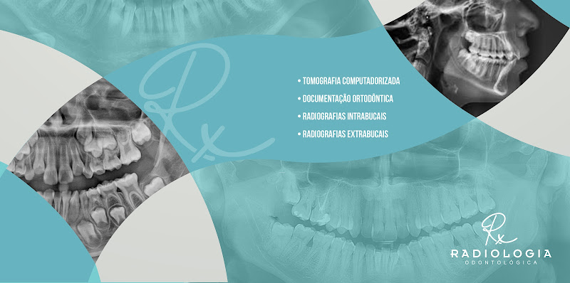 Foto de RX Radiologia Odontologica