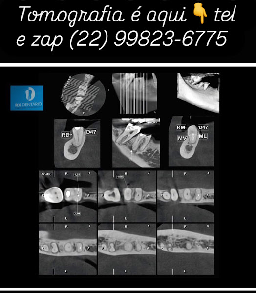 Foto 3 de RXDENTARIO e TOMOGRAFIA - CAMPOS