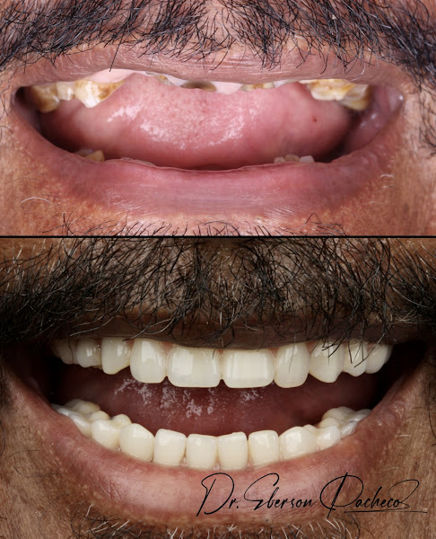 Foto 2 de Ryso Odonto | Clínica Odontológica em Marabá