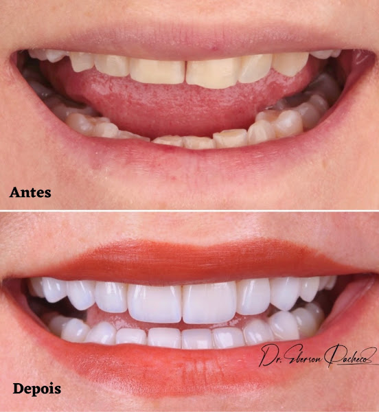 Foto 3 de Ryso Odonto | Clínica Odontológica em Marabá