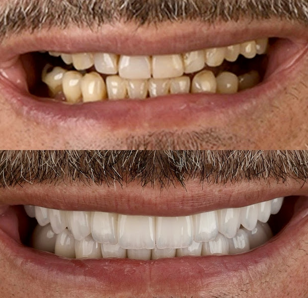 Foto 2 de Ryso Odonto Premium