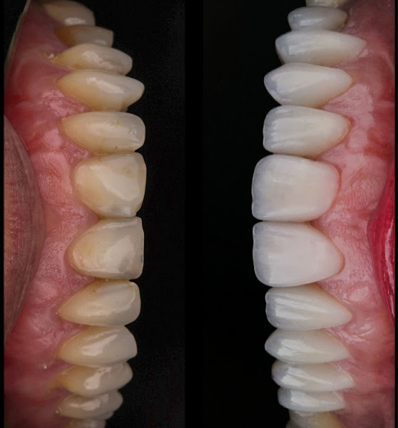 Foto 3 de Ryso Odonto Premium