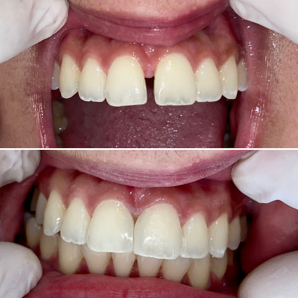 Foto 3 de RZB Odontologia Especializada