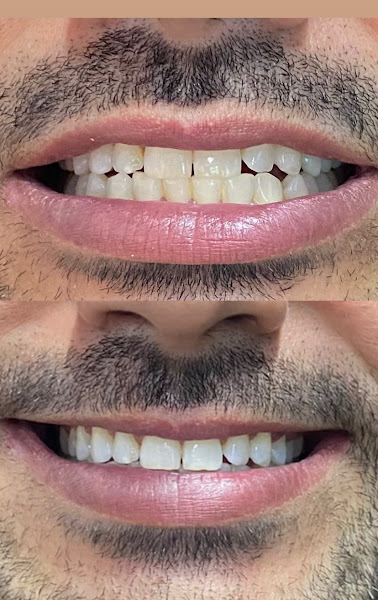Foto 2 de S B Odonto Sorrisos