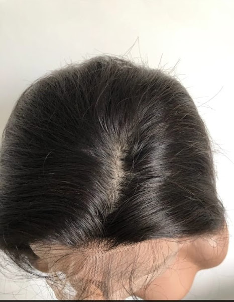Foto 2 de S&F próteses capilares / santo André