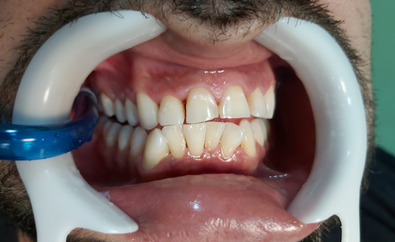 Foto 2 de S. O. I Solução em Odontologia Integrada