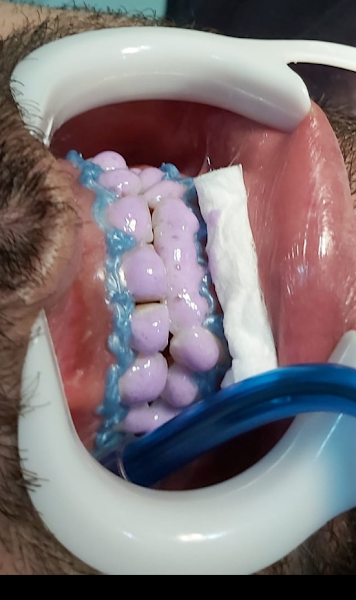 Foto 3 de S. O. I Solução em Odontologia Integrada