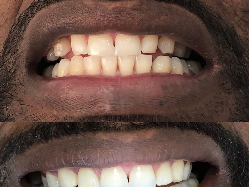 Foto 8 de Sá Odontologia Penha