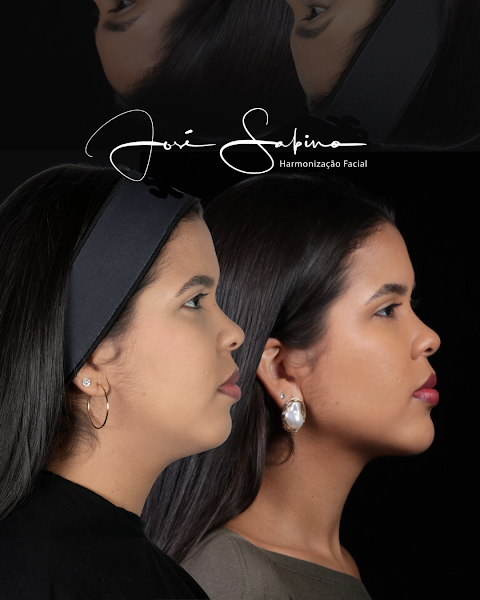 Foto 3 de Sabino Clinic Harmonização Facial - São Luís- MA