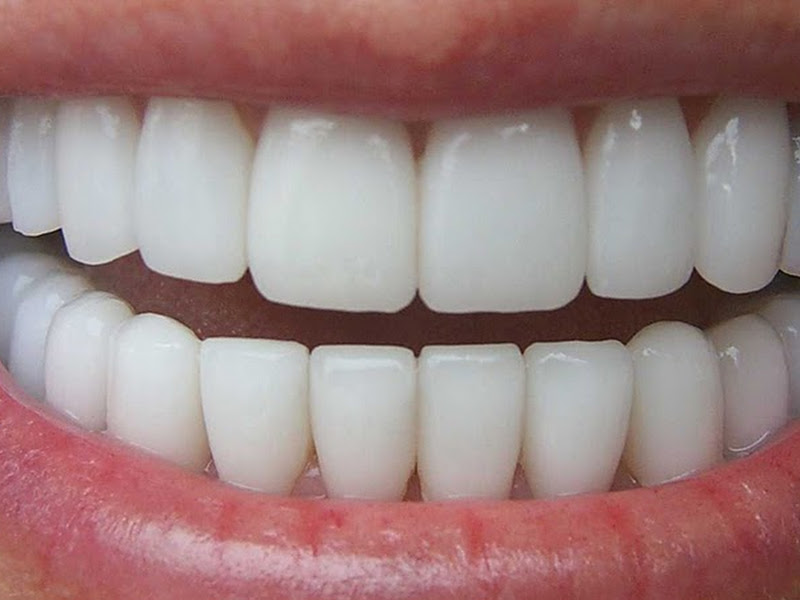 Foto 5 de Sacchet Odontologia