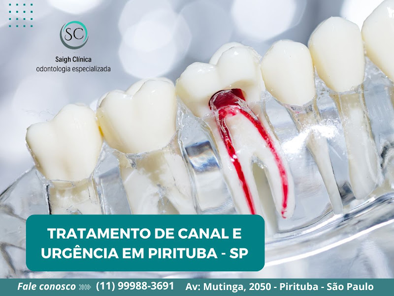 Foto 3 de Saigh Clínica | Dr. Fábio Saigh | Dentista em Pirituba