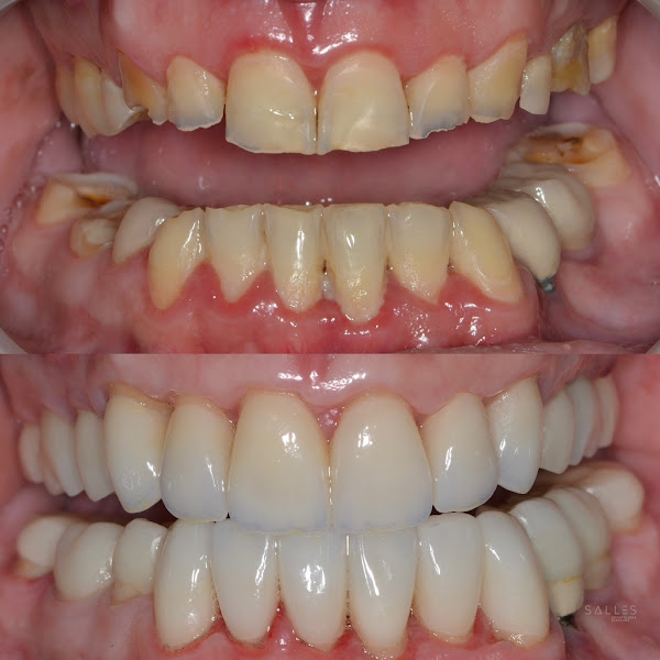 Foto 2 de Salles Odontologia Avançada