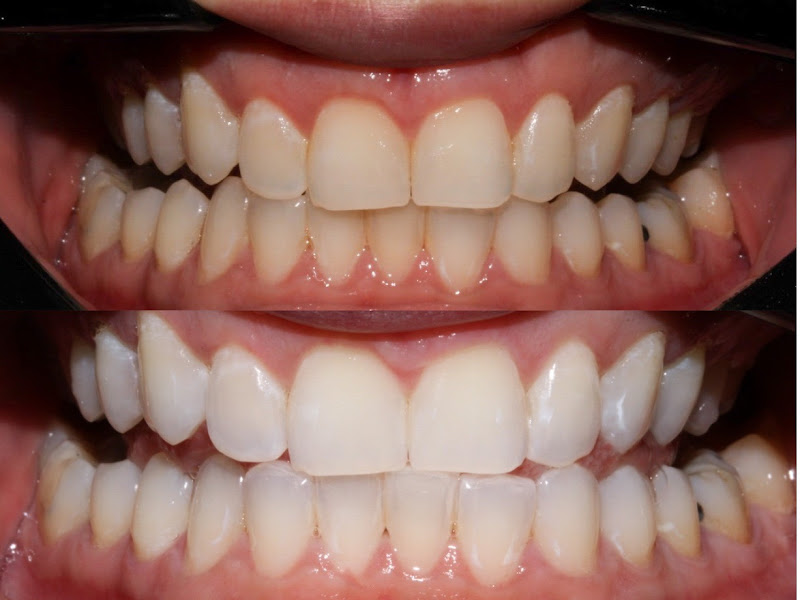 Foto 5 de Salud Odontologia Especializada