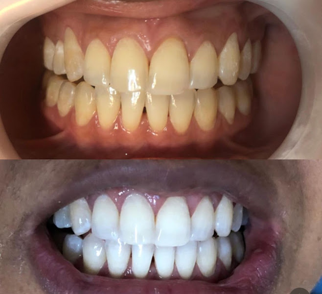 Foto 2 de Salud - Odontologia Integrada