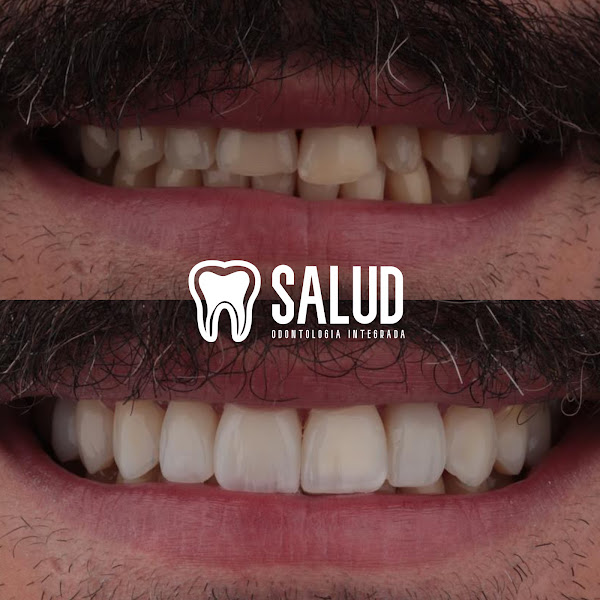 Foto 3 de Salud - Odontologia Integrada