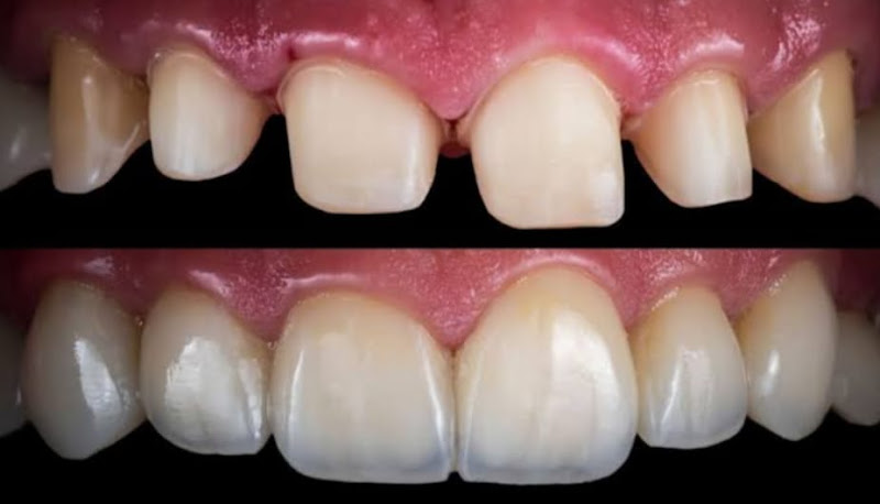 Foto 2 de Sâmea Rocha Odontologia