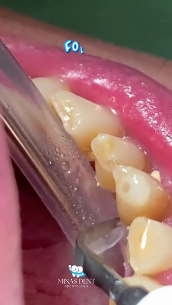 Foto 3 de Samira Morais Odontologia Integrada