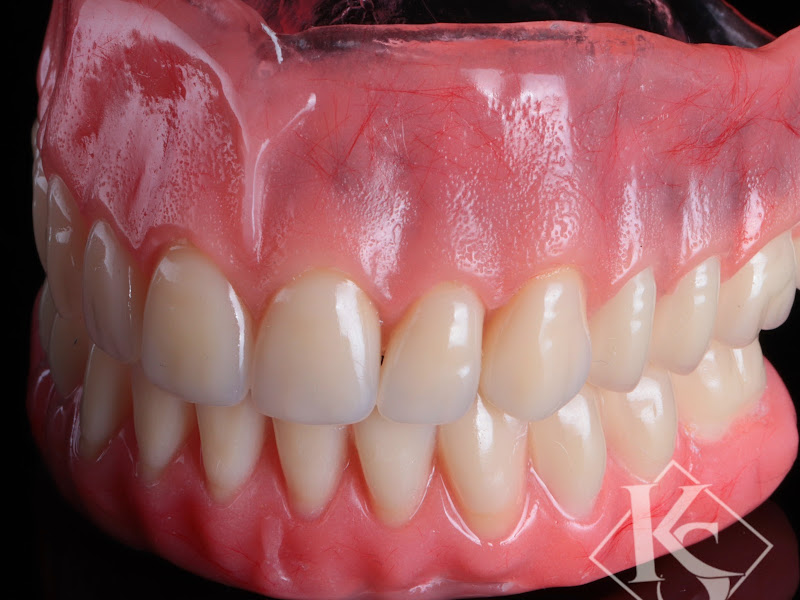 Foto 10 de Sampaio Odontologia - Implantes Dentários, Próteses, Aparelhos Invisalign, Dentista em João Pessoa