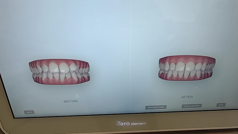 Foto 3 de Samya Cabral Odontologia Ortodontista Invisalign