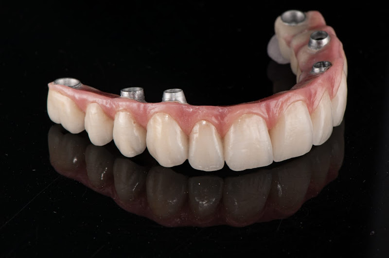 Foto 2 de San Freitas - Prótese Dentária