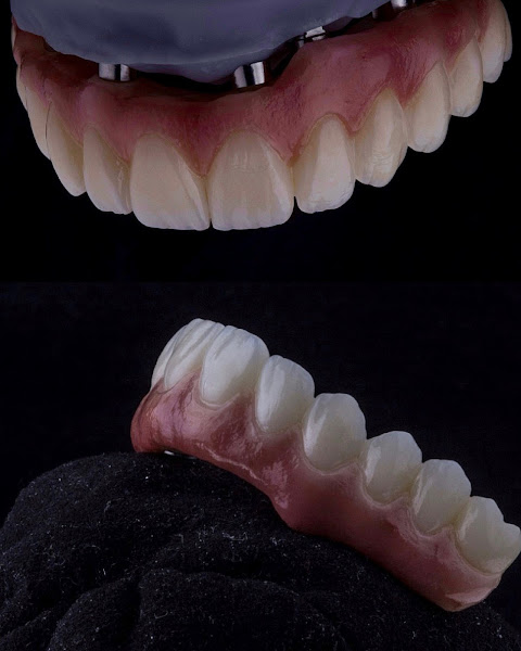 Foto 2 de Sanare Odontologia - Implantes Dentários, Próteses, Aparelho, Dentista em Blumenau
