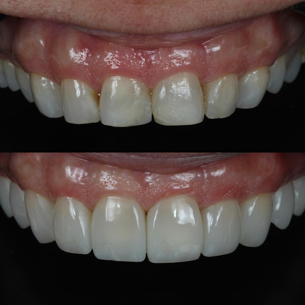 Foto 3 de Santa Justina Odontologia | Dentista na Vila Olímpia | Facetas e Alinhadores