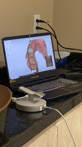 Foto 4 de Santa Mônica Odontologia | Dentista em Santa Mônica-BH | Ortodontia - Próteses - Implantes - Clareamento - Facetas - Extração