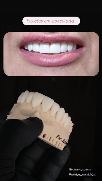 Foto 3 de Santo Dente Odontologia - Dentista em Dourados | Especialista em Implante Dentário