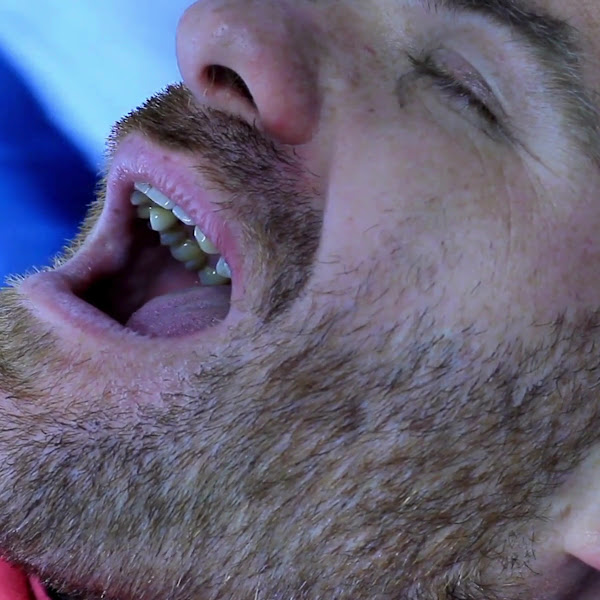 Foto 4 de Santo Dente Odontologia - Dentista em Dourados | Especialista em Implante Dentário