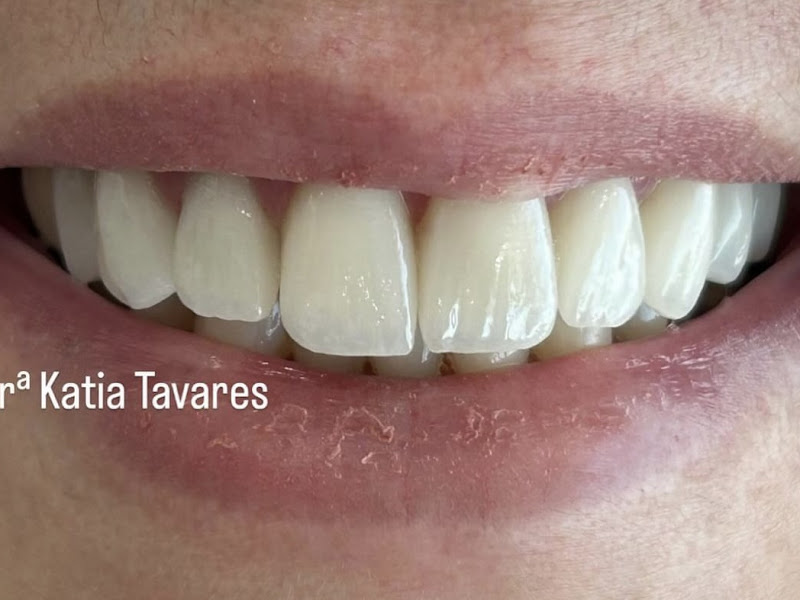 Foto 9 de Sapata Odontologia | Dentista em Guarulhos | Invisalign