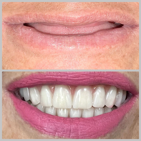 Foto 2 de Saúde Center Odontologia | Implante dentário | Dentista | Implantes | Unidade Delfino Magalhães