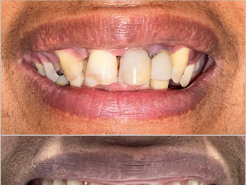 Foto 4 de Saúde Center Odontologia | Implante dentário | Dentista | Implantes | Unidade Delfino Magalhães
