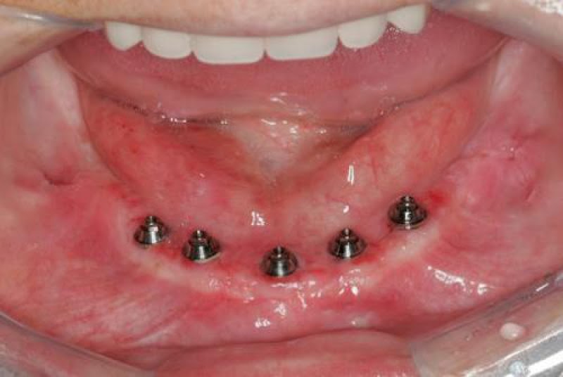 Foto 2 de Saúde mais odontologia