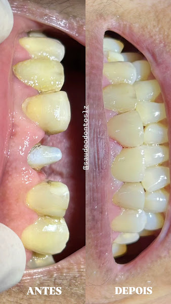 Foto 4 de Saúde Odonto