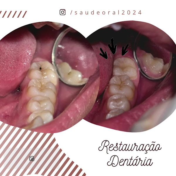 Foto 2 de + Saúde Oral - Clínica Odontológica - Ananindeua-PA