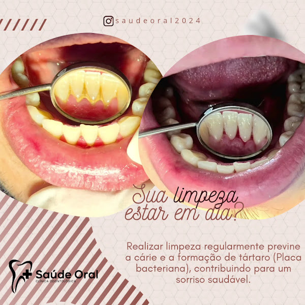 Foto 3 de + Saúde Oral - Clínica Odontológica - Ananindeua-PA