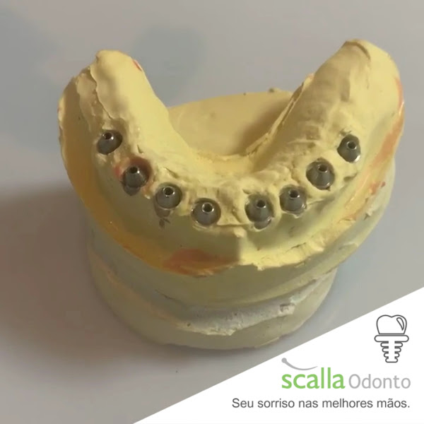 Foto 4 de Scalla Odonto