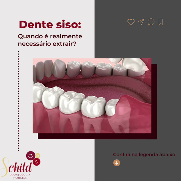 Foto 4 de Schild Odontologia Familiar