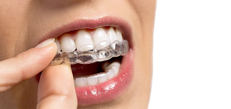 Foto 5 de Schild Odontologia Familiar