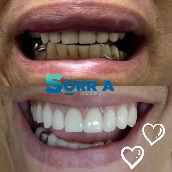 Foto 3 de Sempre Sorria Odontologia - Dr Carlos Prado - Dentista em Aparecida-SP