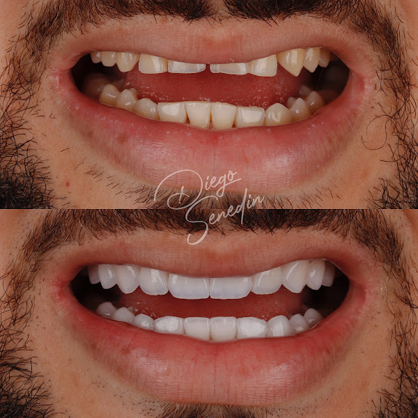 Foto 3 de Senedin Odontologia