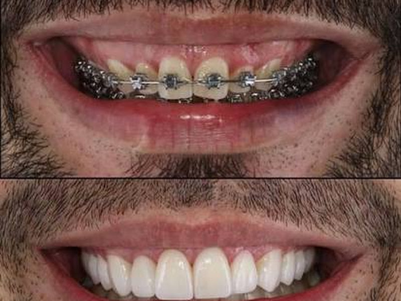 Foto 6 de Serejo Odontologia Compensa