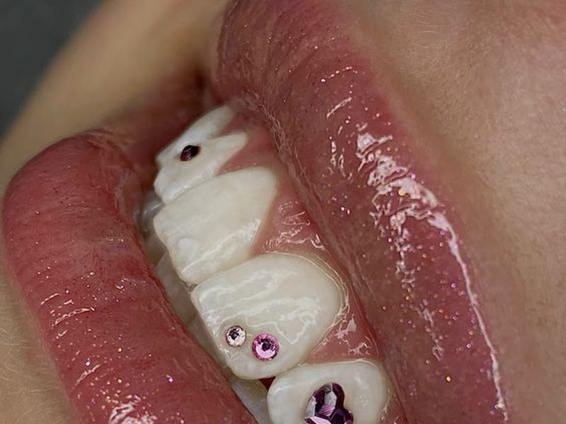 Foto 7 de Serena Odontologia