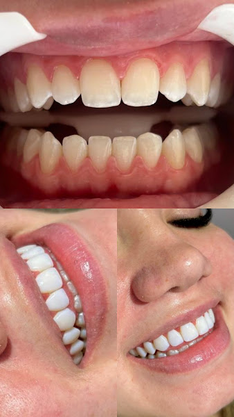 Foto 2 de Seven odontologia e estética