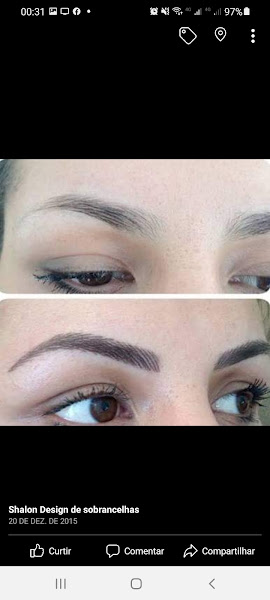 Foto 3 de Shalon Estética Avançada | Botox | Micropigmentação | Ceilândia DF