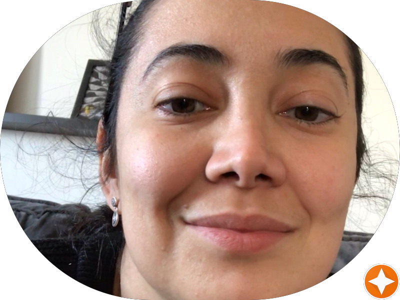 Foto 2 de Shana Oliveira Machado - Cirurgiã Dentista