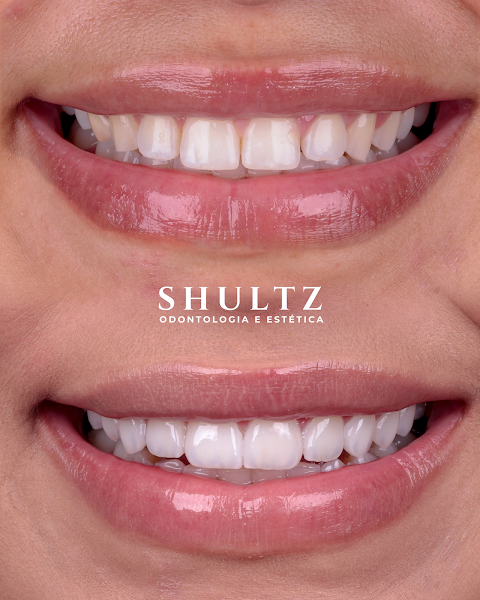 Foto 2 de Shultz Odontologia e Estética