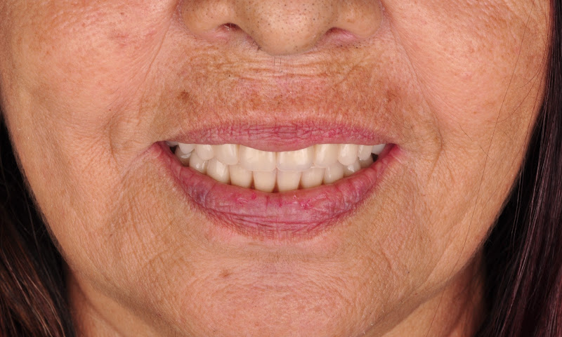 Foto 2 de Sicuti Odontologia - Dentistas | Implante Dentário | Ortodontista em São Vicente SP