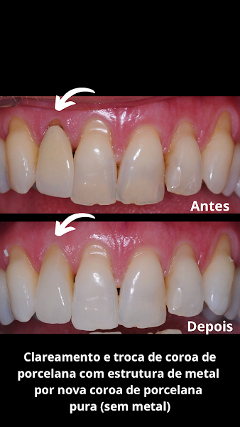 Foto 3 de Sicuti Odontologia - Dentistas | Implante Dentário | Ortodontista em São Vicente SP
