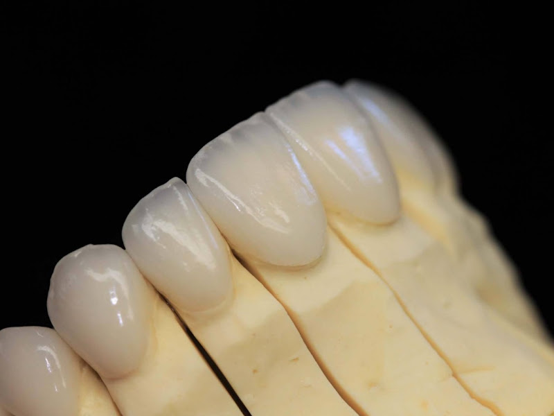 Foto 8 de Sier – Clínica Odontológica